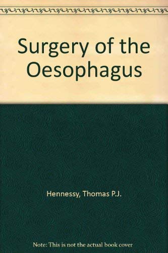 Surgery of the Oesophagus - Retail Maharaj