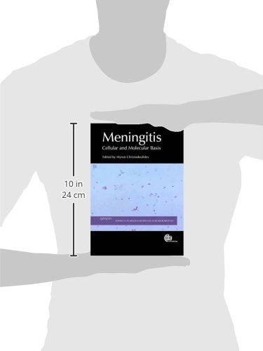 Meningitis: Cellular and Molecular Basis: 26 (Advances in Molecular and Cellular Microbiology) - Retail Maharaj