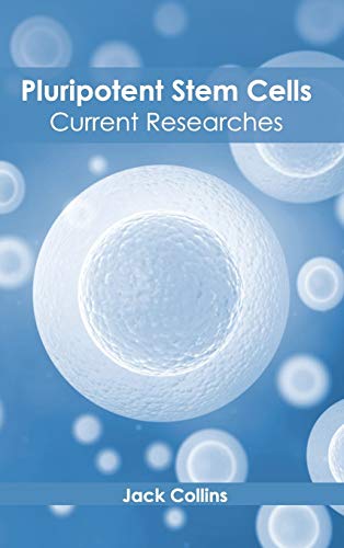 Pluripotent Stem Cells: Current Researches - Retail Maharaj