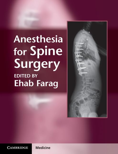 Anesthesia for Spine Surgery (Cambridge Medicine (Hardcover)) - Retail Maharaj