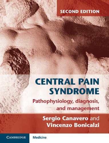 Central Pain Syndrome: Pathophysiology, Diagnosis and Management - Retail Maharaj