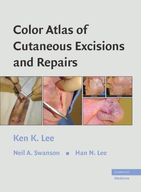 Color Atlas of Cutaneous Excisions and Repairs - Retail Maharaj
