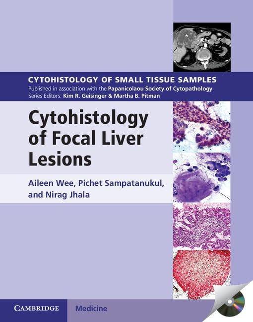 CYTOHISTOLOGY OF FOCAL LIVER LESIONS (Cytohistology of Small Tissue Samples) - Retail Maharaj