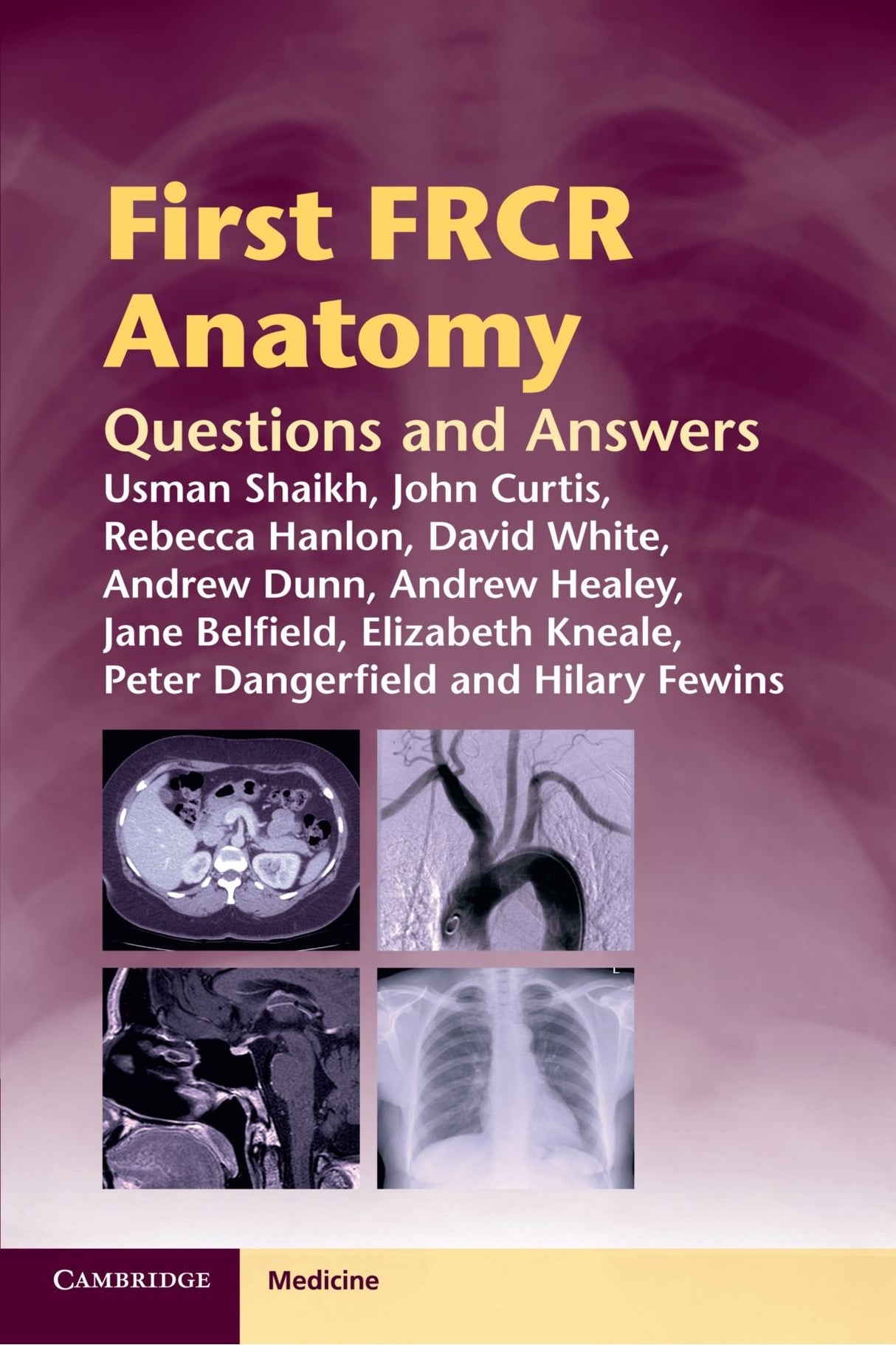 First FRCR Anatomy: Questions and Answers (Cambridge Medicine (Paperback)) - Retail Maharaj