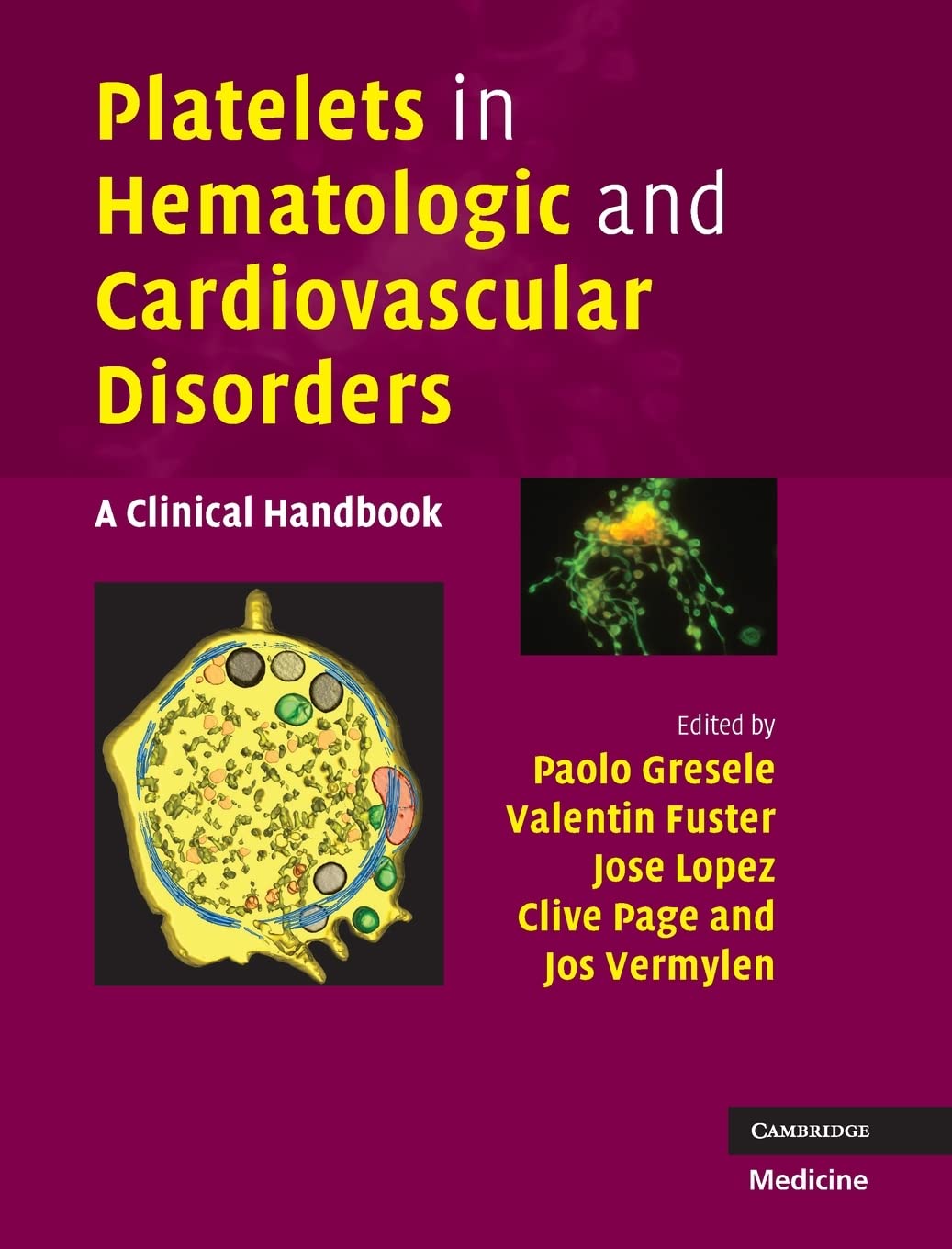 Platelets in Hematologic and Cardiovascular Disorders: A Clinical Handbook - Retail Maharaj