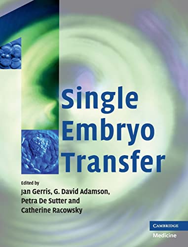 Single Embryo Transfer - Retail Maharaj