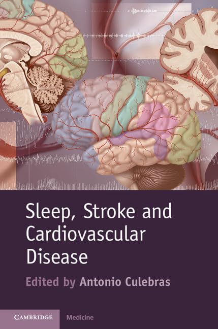 Sleep, Stroke and Cardiovascular Disease - Retail Maharaj