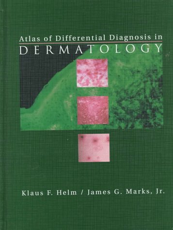 Atlas of Differential Diagnosis in Dermatology - Retail Maharaj