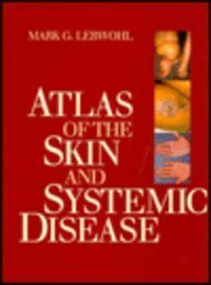 The Skin and Systemic Disease: Color Atlas - Retail Maharaj