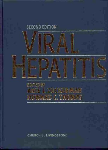Viral Hepatitis - Retail Maharaj