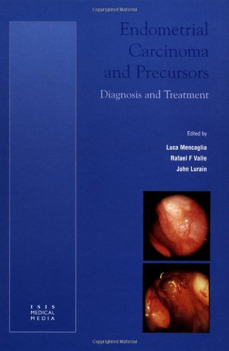 Endometrial Carcinoma and Precursors: Diagnosis and Treatment - Retail Maharaj