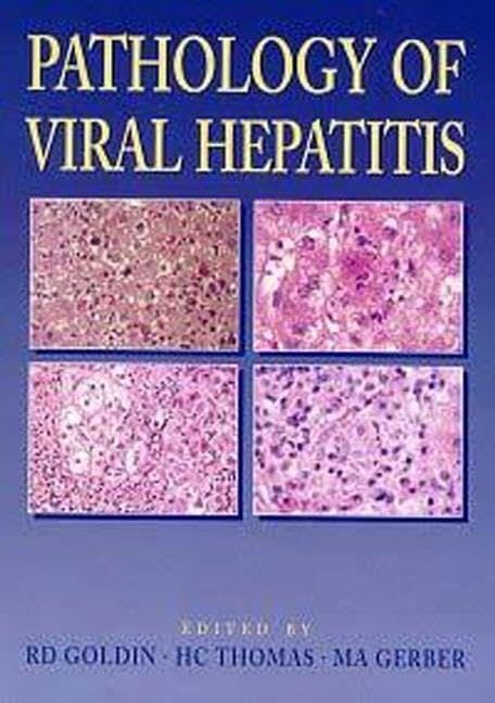 Pathology of Viral Hepatitis - Retail Maharaj