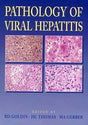 Pathology of Viral Hepatitis - Retail Maharaj