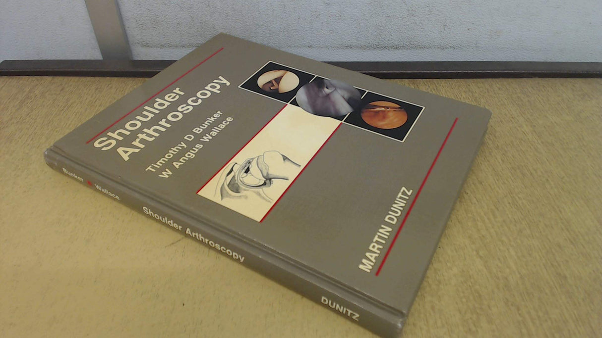 Shoulder Arthroscopy - Retail Maharaj