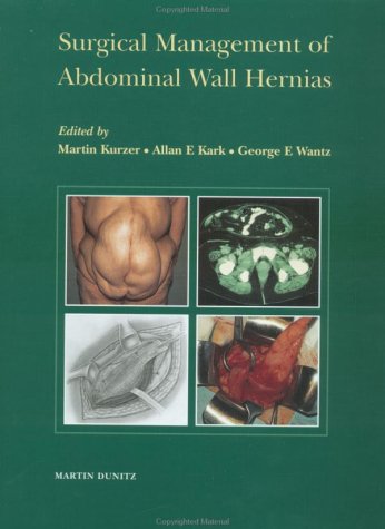 Surgical Management of Abdominal Wall Hernias - Retail Maharaj