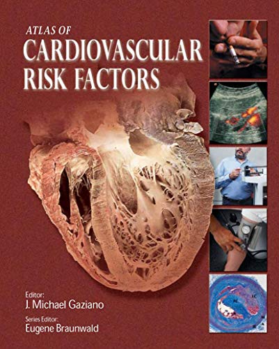 ATLAS OF CARDIOVASCULAR RISK FACTORS (ATLAS OF HEART DISEASES (UNNUMBERED).) - Retail Maharaj