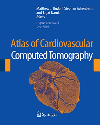 Atlas of Cardiovascular Computed Tomography - Retail Maharaj