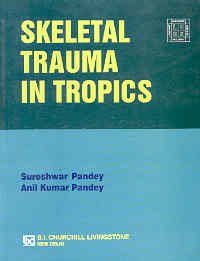 Skeletal Trauma In Tropics - Retail Maharaj