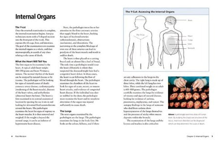 Postmortem: Establishing the Cause of Death - Retail Maharaj
