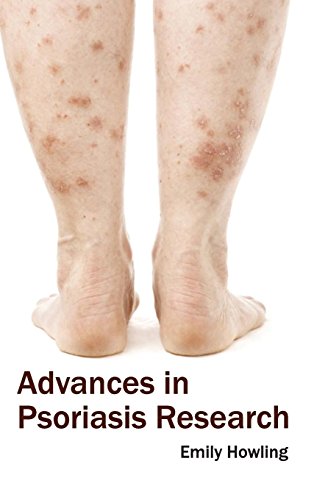 Advances in Psoriasis Research - Retail Maharaj