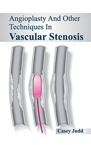 Angioplasty and Other Techniques in Vascular Stenosis - Retail Maharaj