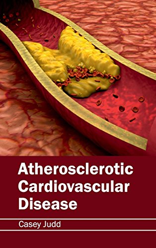Atherosclerotic Cardiovascular Disease - Retail Maharaj