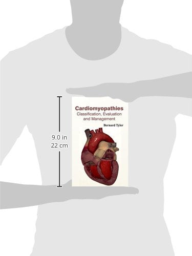 Cardiomyopathies: Classification, Evaluation and Management - Retail Maharaj