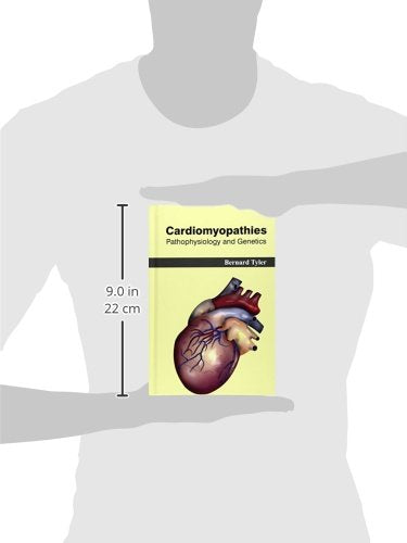 Cardiomyopathies: Pathophysiology and Genetics - Retail Maharaj