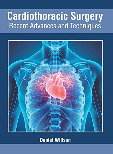 Cardiothoracic Surgery: Recent Advances and Techniques - Retail Maharaj