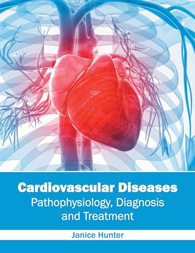 Cardiovascular Diseases: Pathophysiology, Diagnosis and Treatment - Retail Maharaj