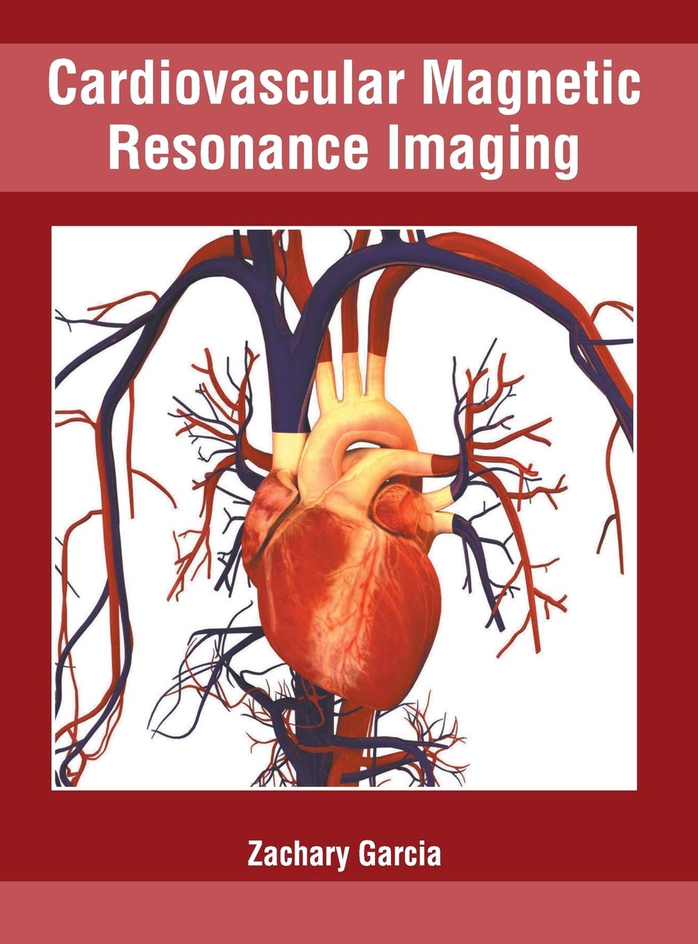 Cardiovascular Magnetic Resonance Imaging - Retail Maharaj