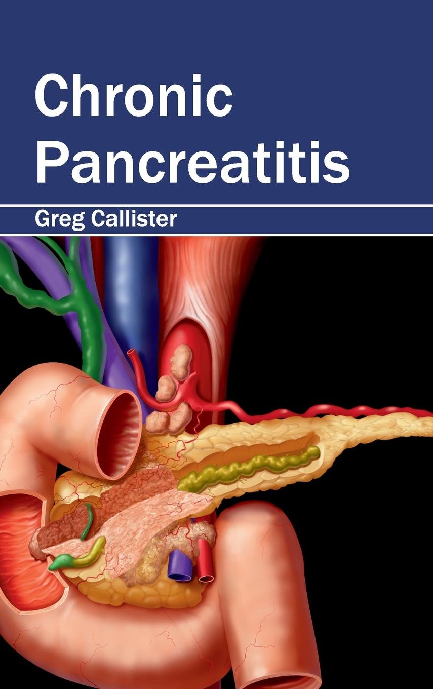 Chronic Pancreatitis - Retail Maharaj