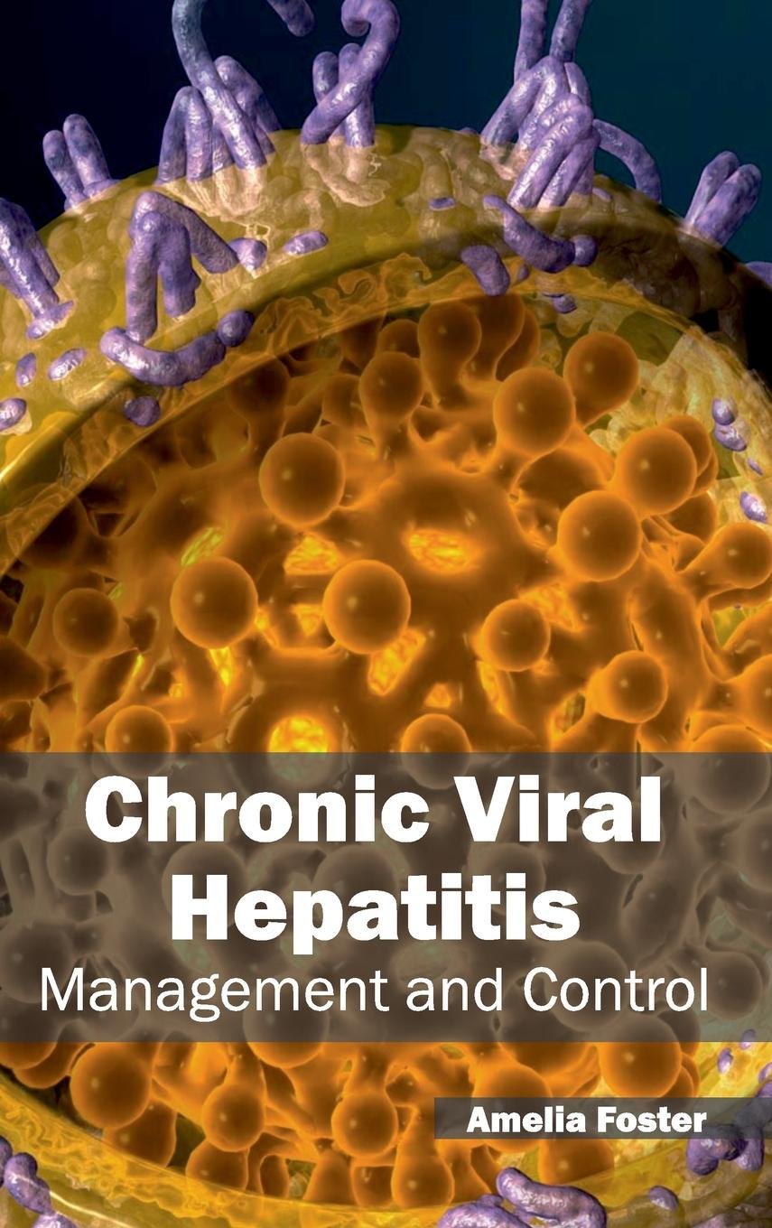 Chronic Viral Hepatitis: Management and Control - Retail Maharaj