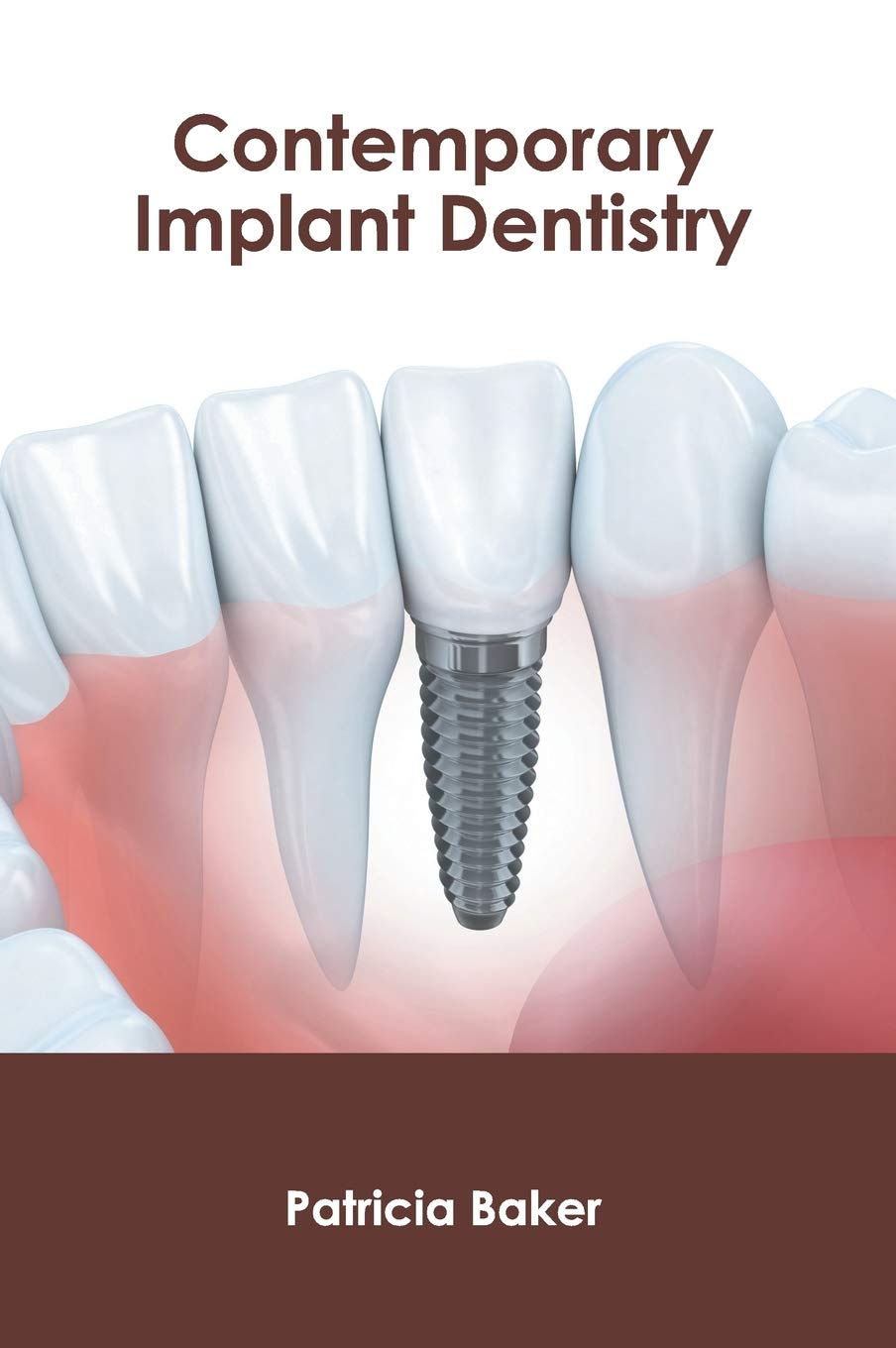 Contemporary Implant Dentistry - Retail Maharaj