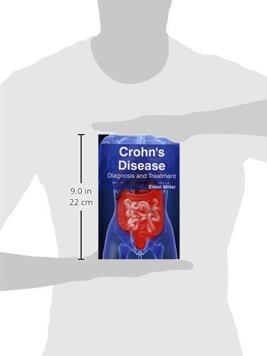 Crohn's Disease: Diagnosis and Treatment - Retail Maharaj