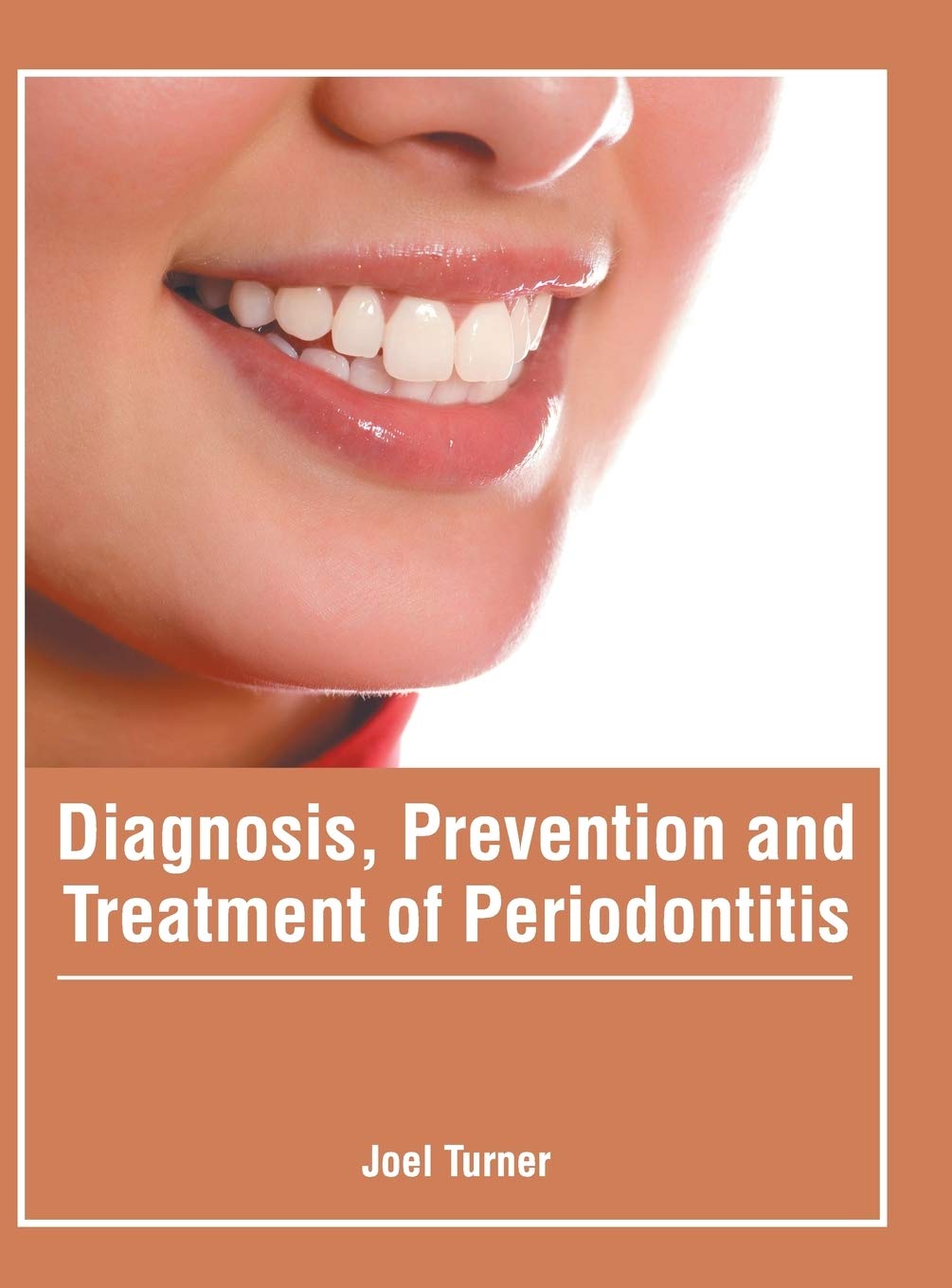 Diagnosis, Prevention and Treatment of Periodontitis - Retail Maharaj