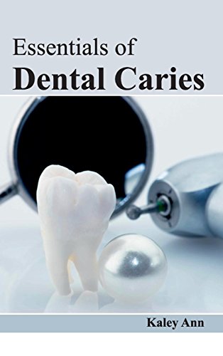 Essentials of Dental Caries - Retail Maharaj