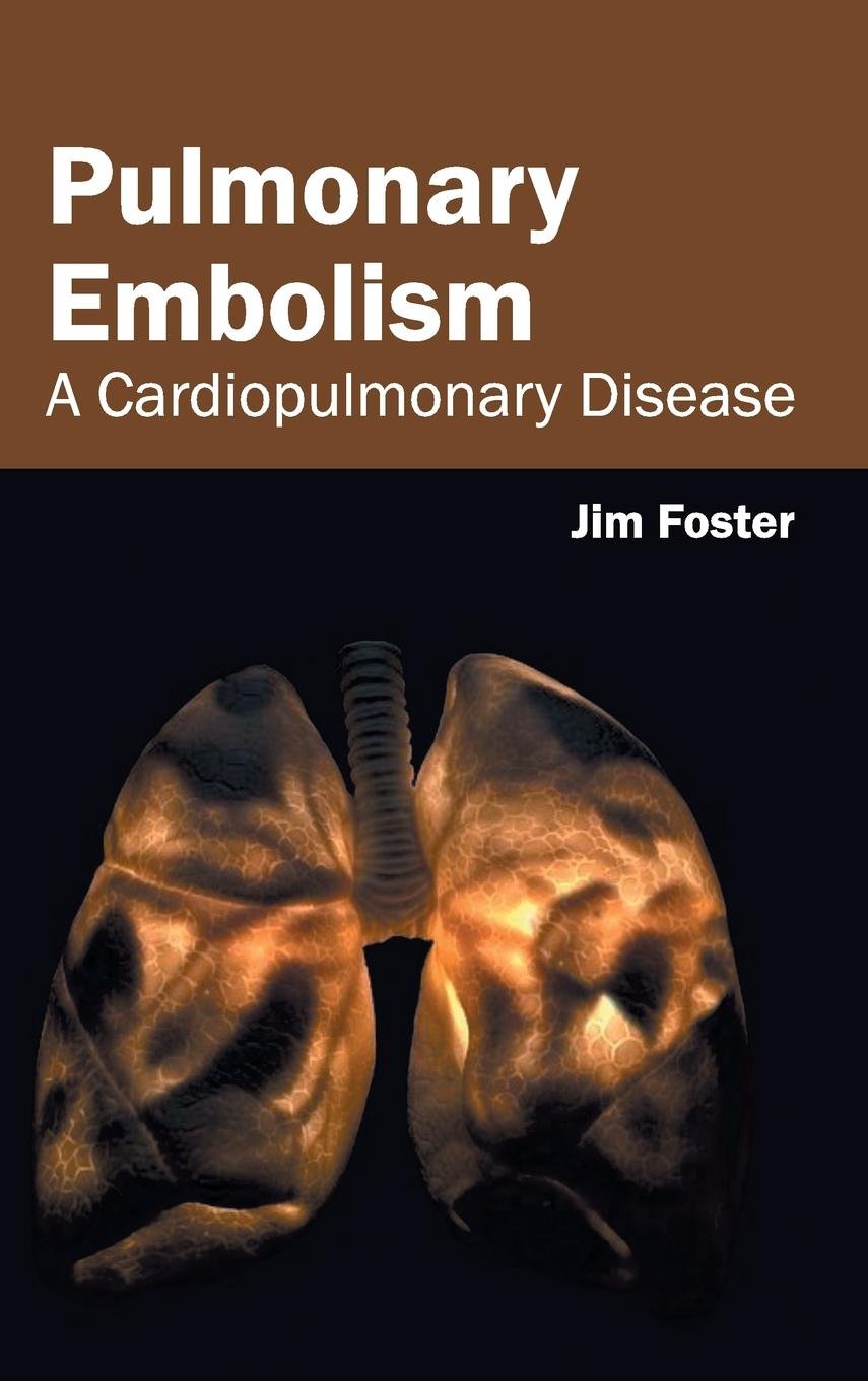Pulmonary Embolism: A Cardiopulmonary Disease - Retail Maharaj