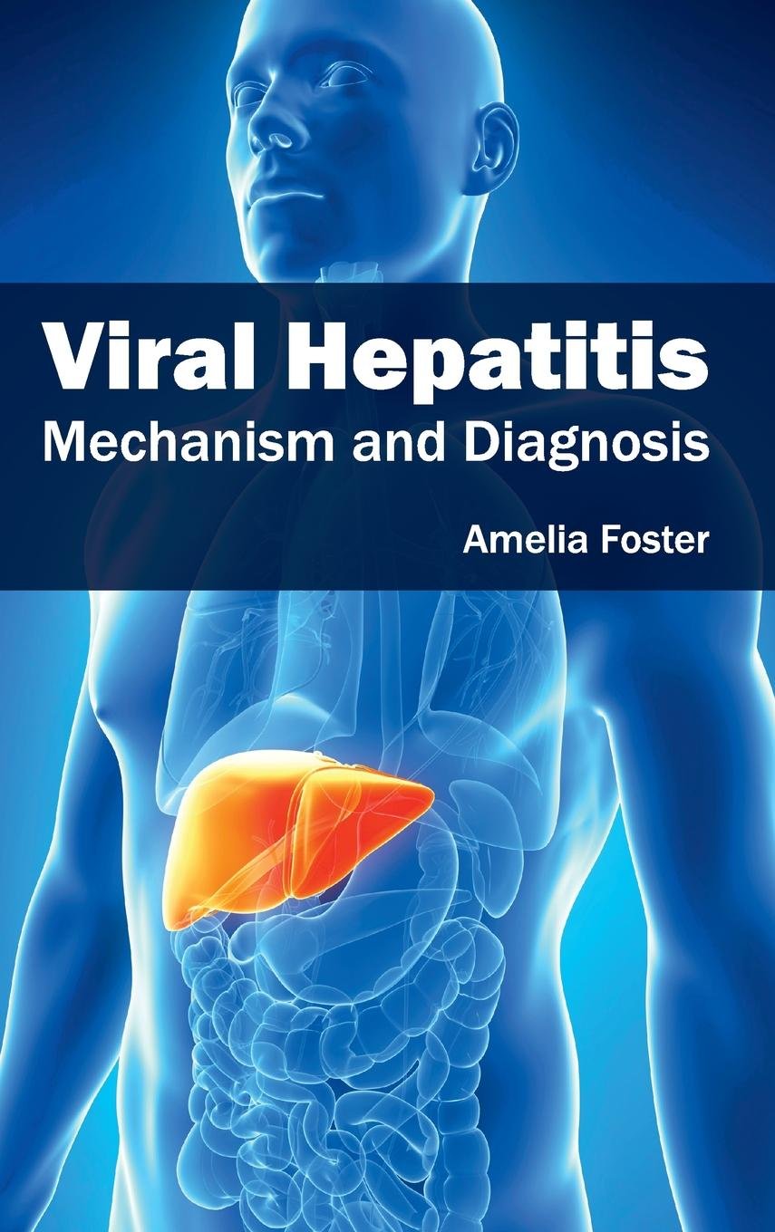 Viral Hepatitis: Mechanism and Diagnosis - Retail Maharaj