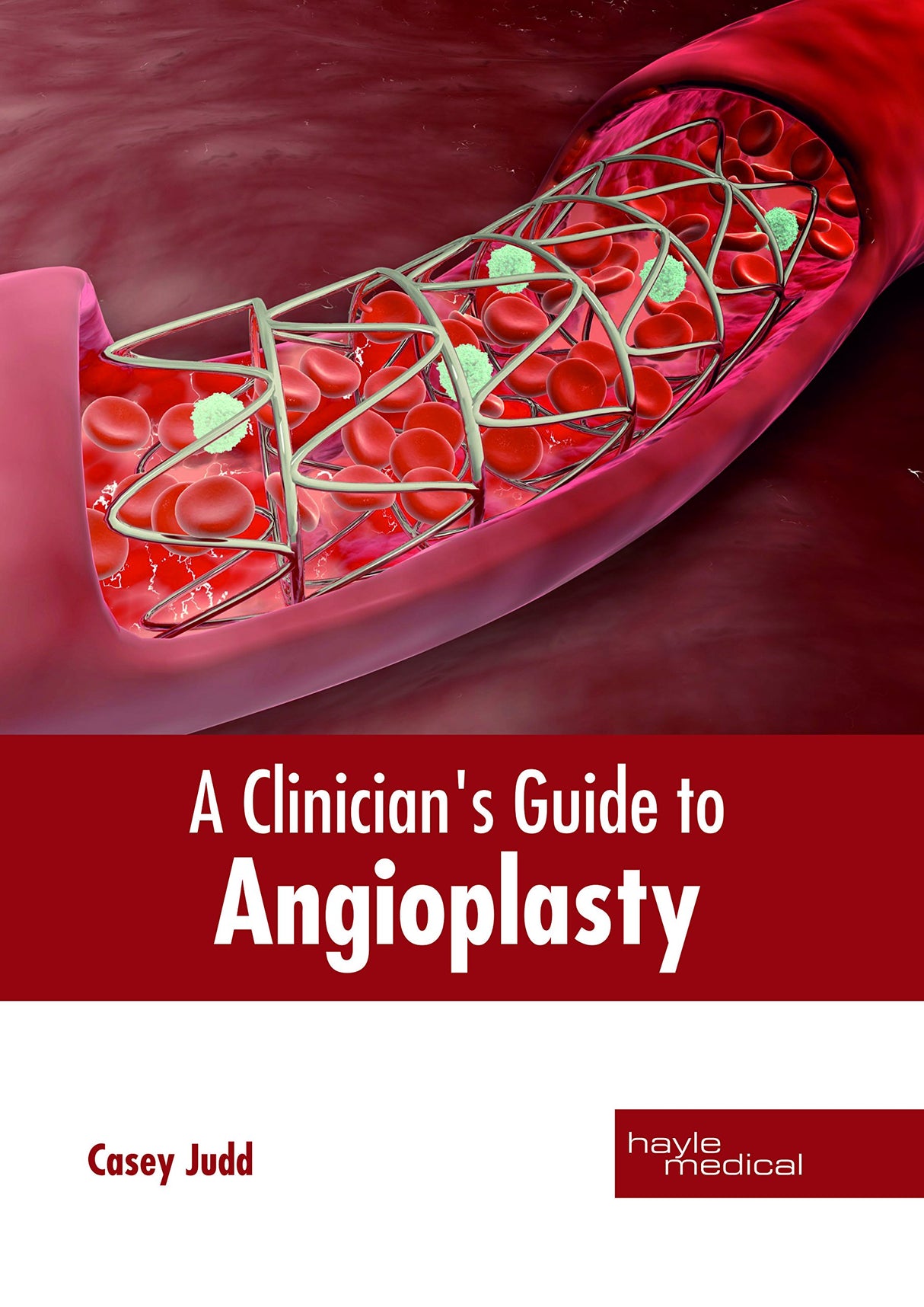 A Clinician's Guide to Angioplasty - Retail Maharaj