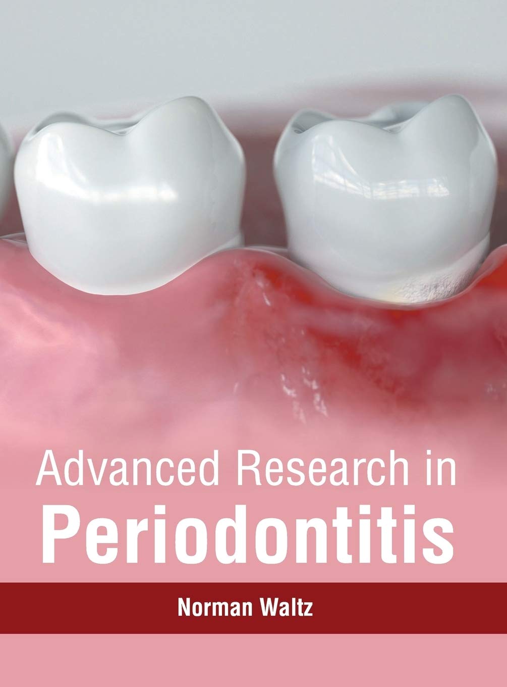 Advanced Research in Periodontitis - Retail Maharaj