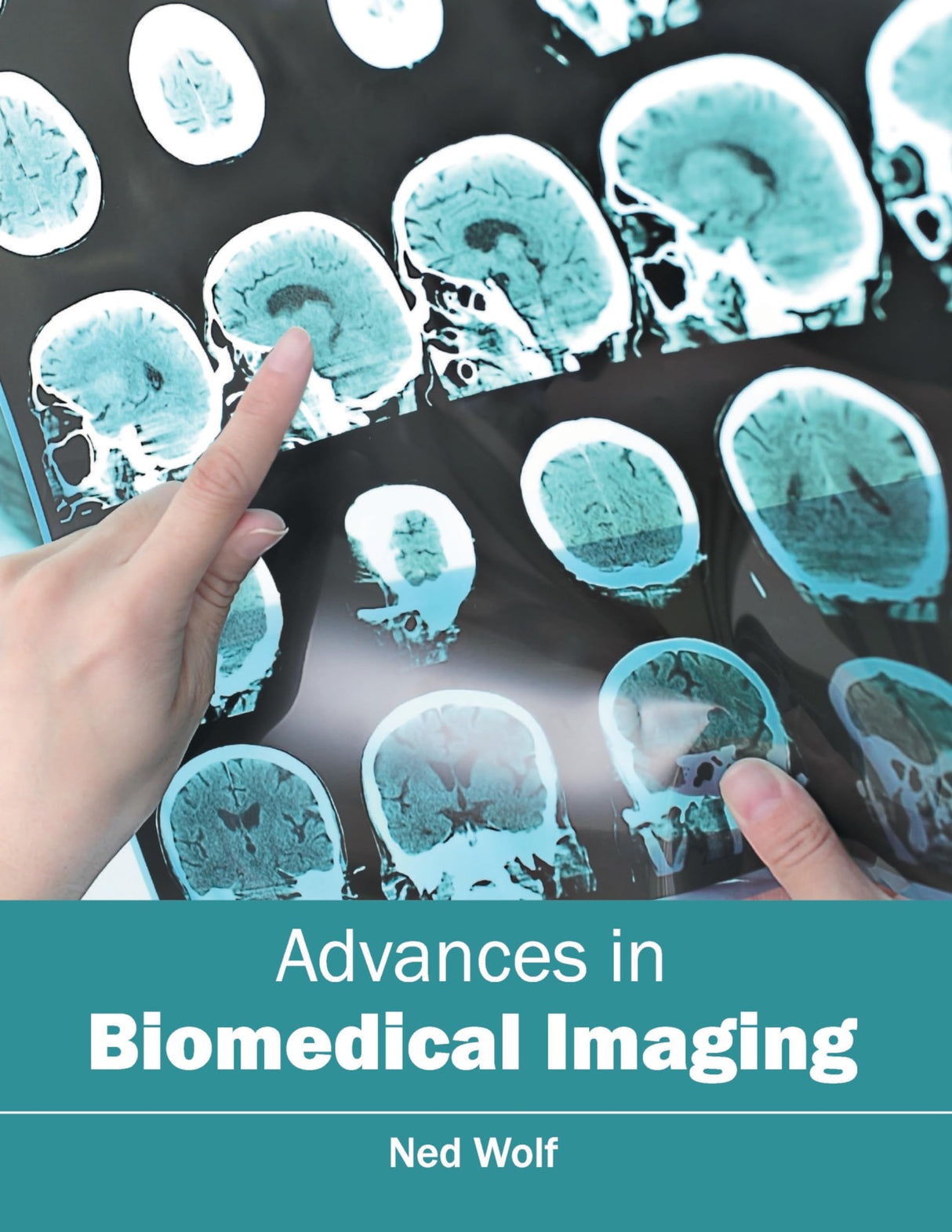 Advances in Biomedical Imaging - Retail Maharaj