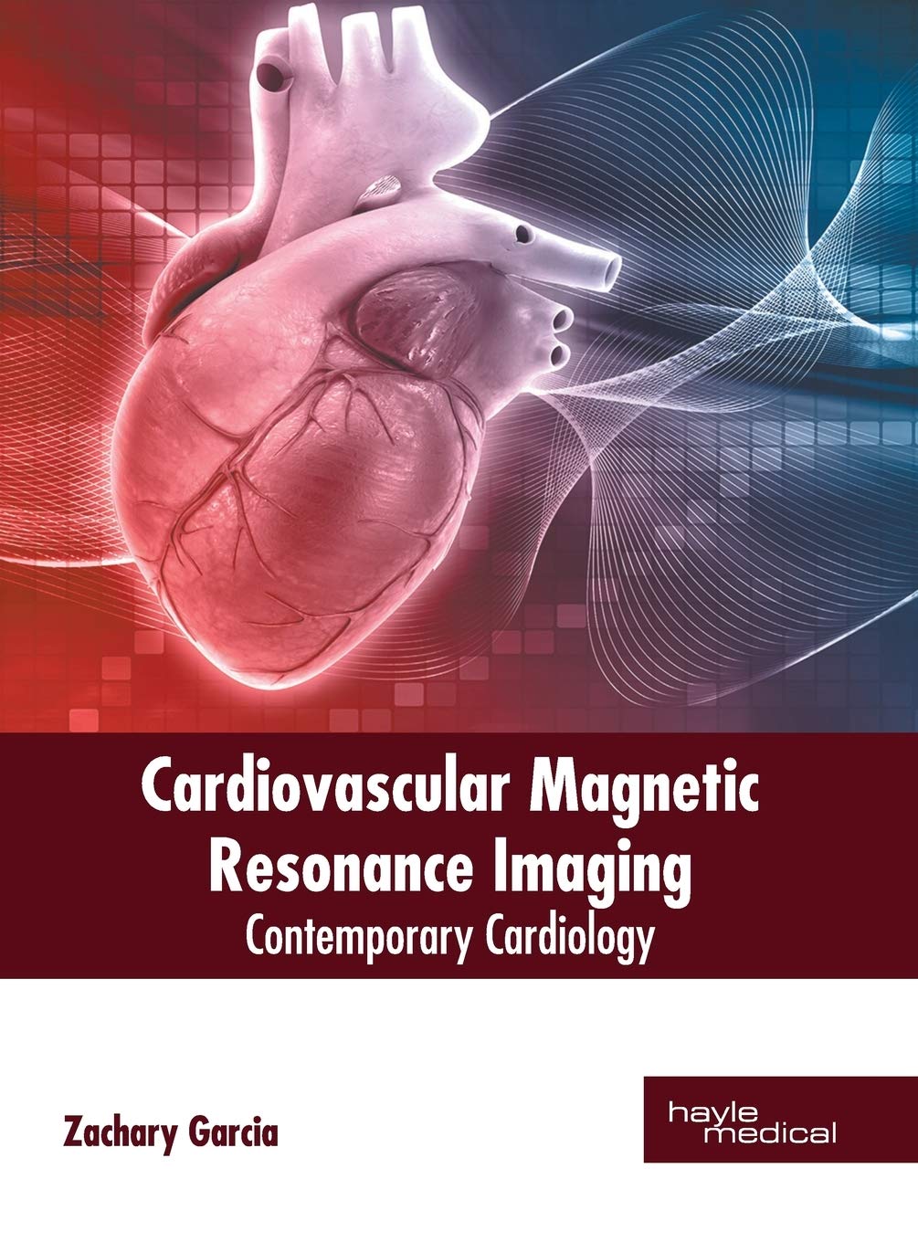 Cardiovascular Magnetic Resonance Imaging: Contemporary Cardiology - Retail Maharaj