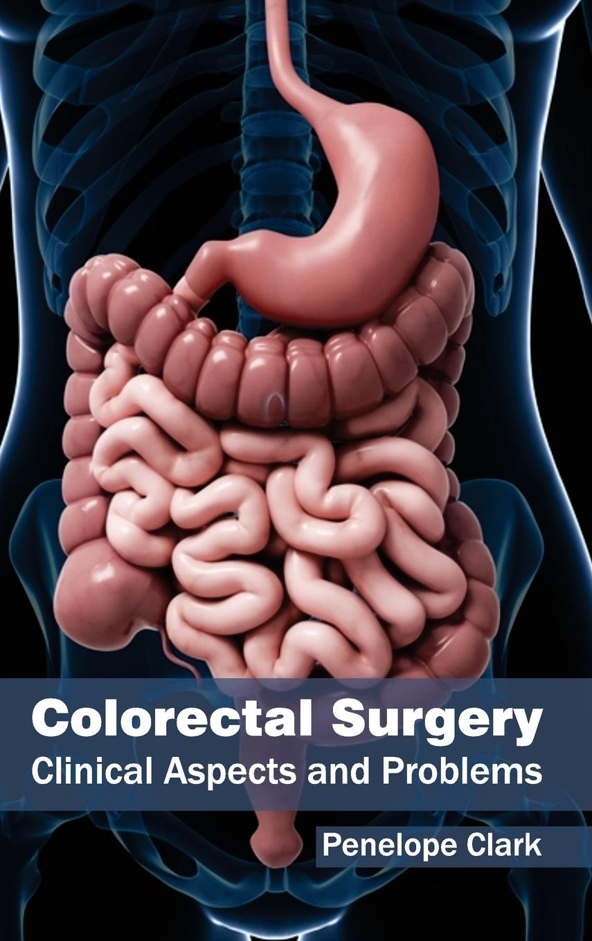 Colorectal Surgery: Clinical Aspects and Problems - Retail Maharaj
