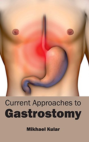 Current Approaches to Gastrostomy - Retail Maharaj