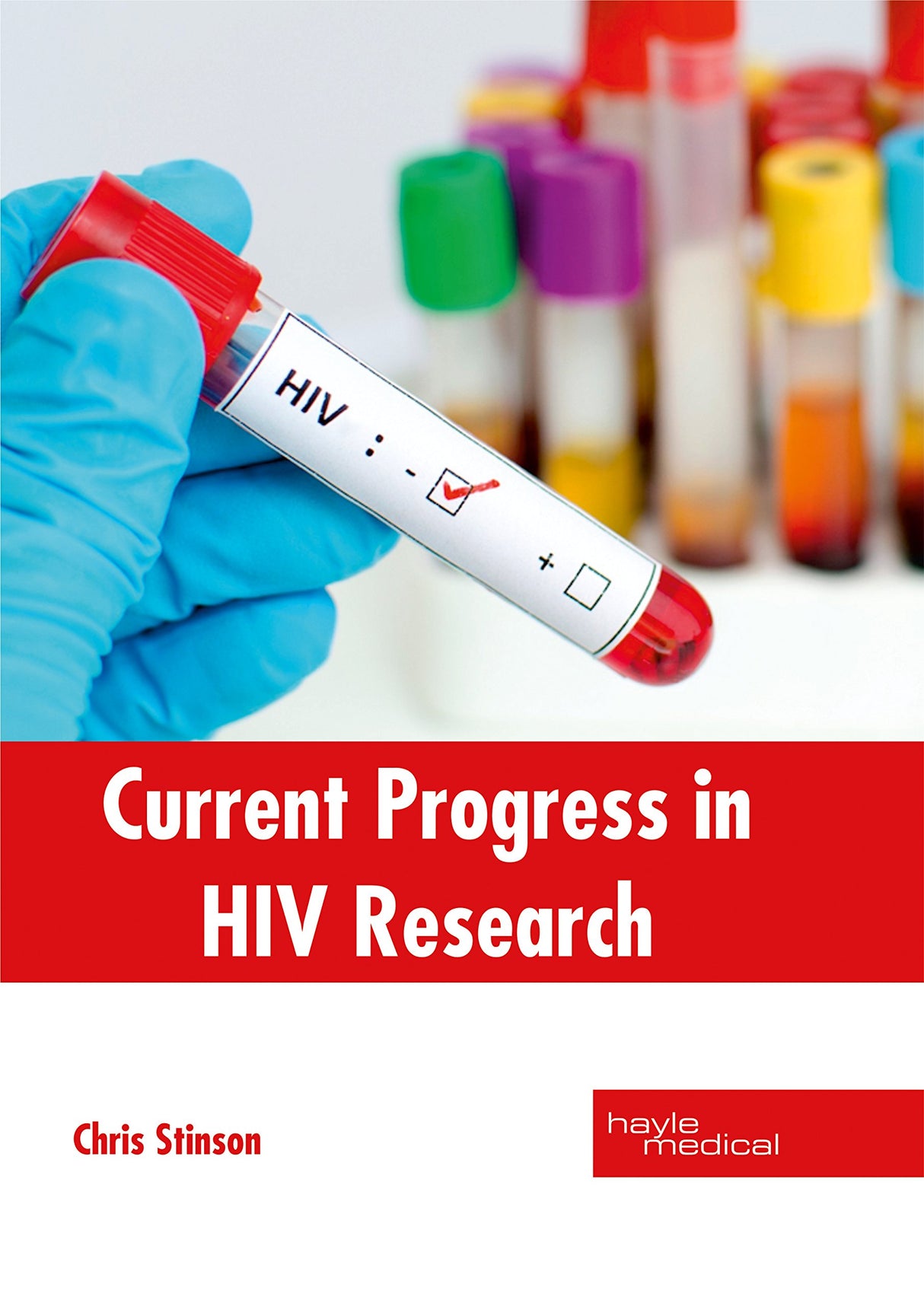 Current Progress in HIV Research - Retail Maharaj