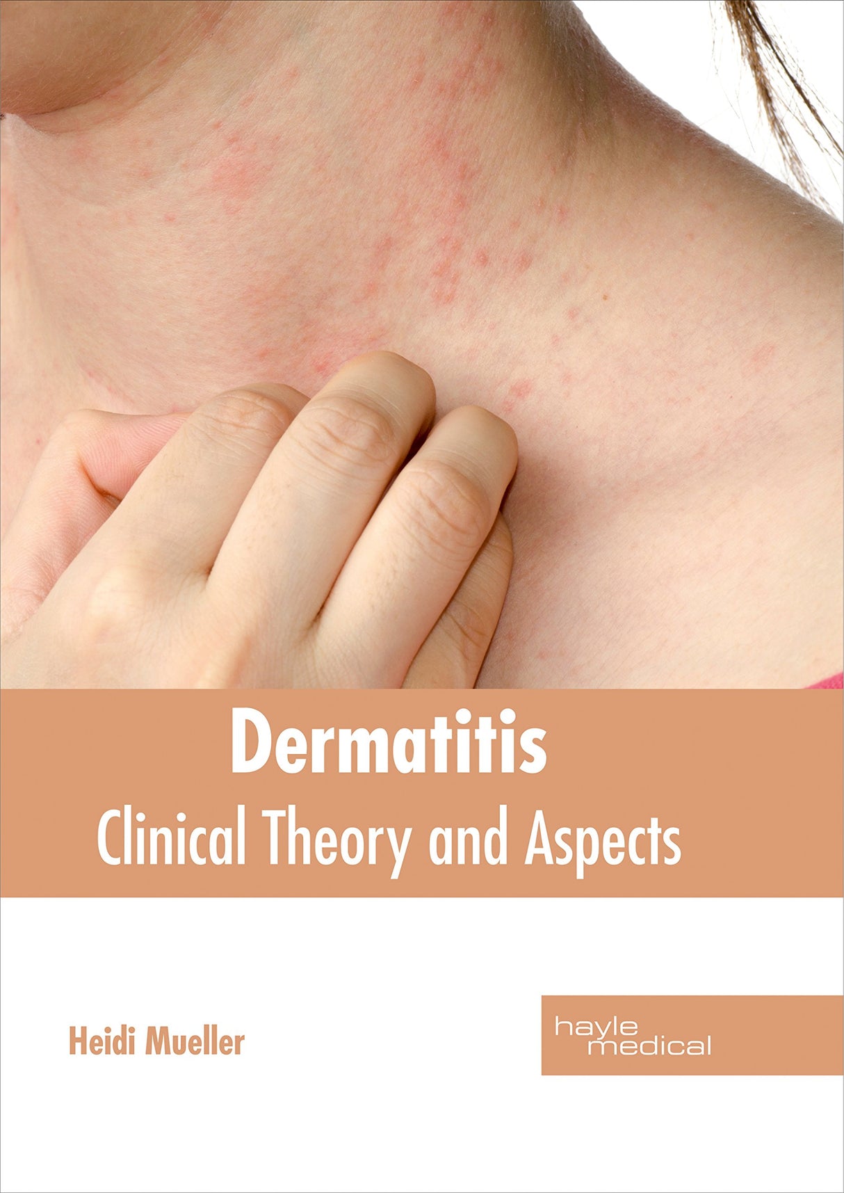 Dermatitis: Clinical Theory and Aspects - Retail Maharaj