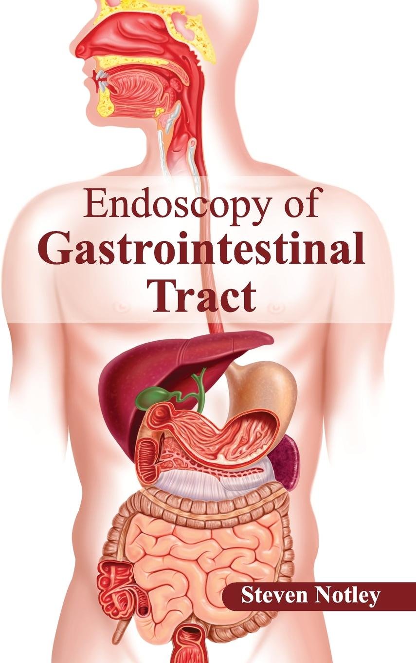 Endoscopy of Gastrointestinal Tract - Retail Maharaj