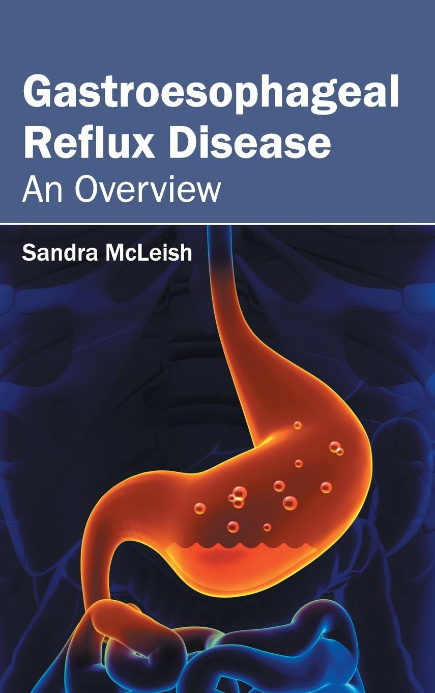 Gastroesophageal Reflux Disease: An Overview - Retail Maharaj
