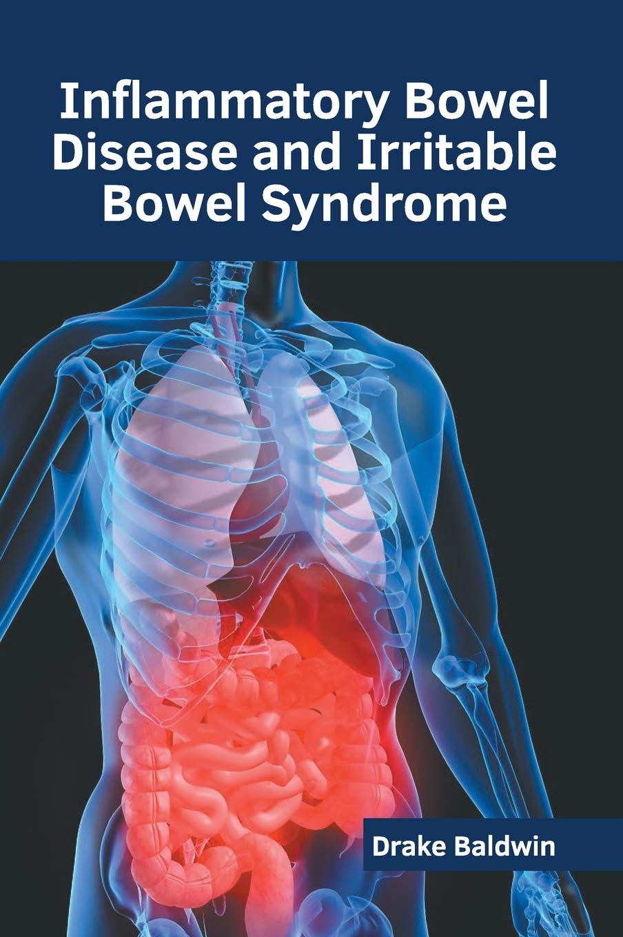 Inflammatory Bowel Disease and Irritable Bowel Syndrome - Retail Maharaj